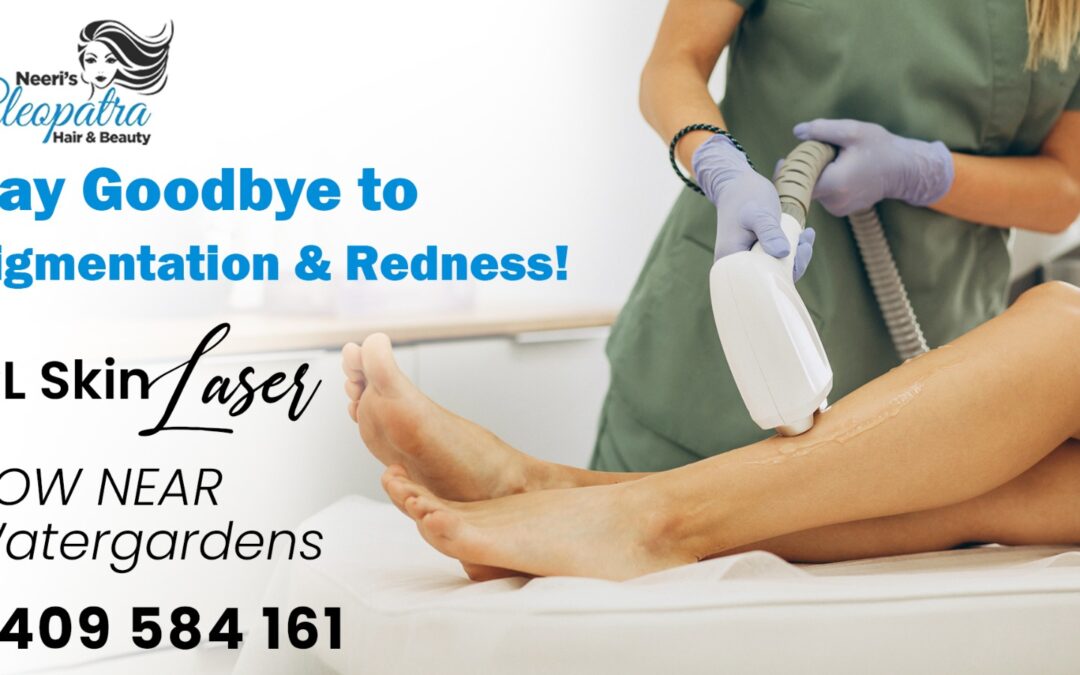 Say Goodbye to Pigmentation & Redness – IPL Skin Laser Now Available Near Watergardens