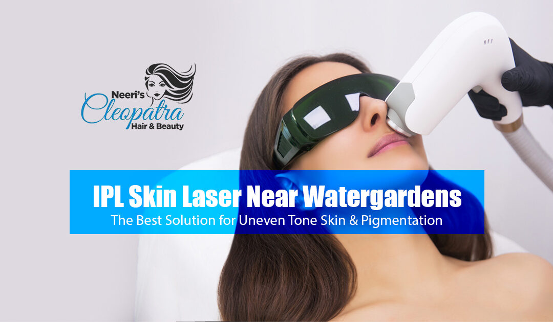 IPL Skin Laser Near Watergardens: The Best Solution for Uneven Tone Skin & Pigmentation